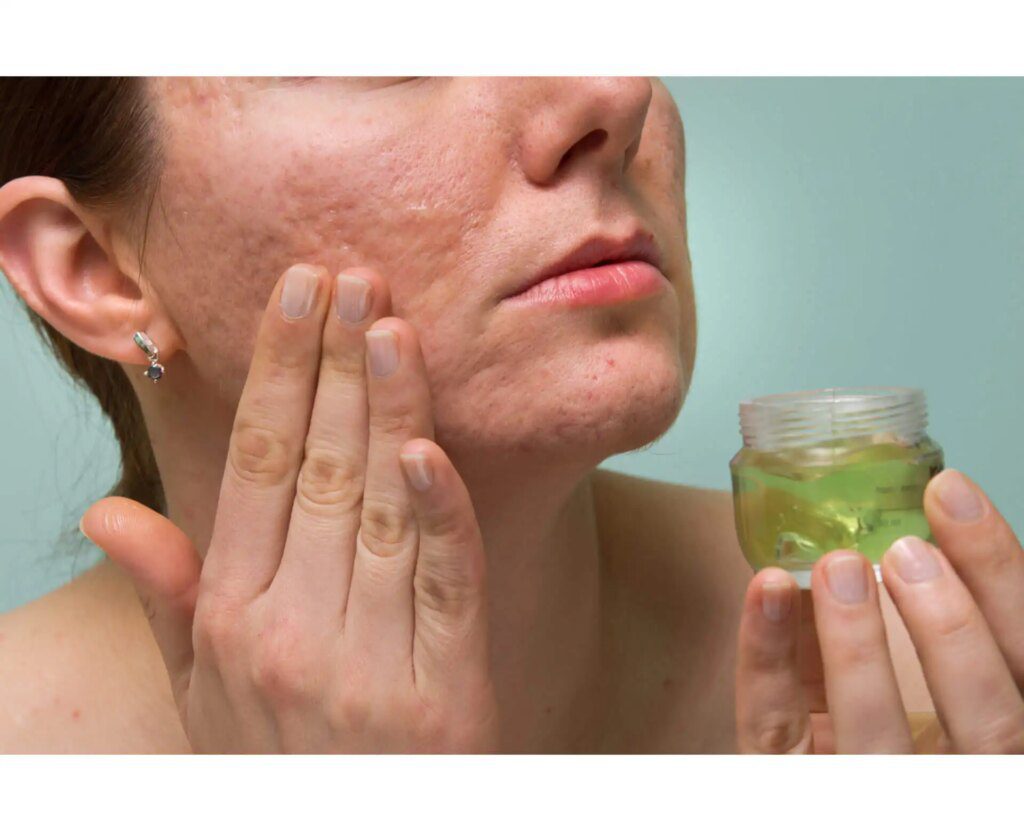 La chlorophylline, une source d'antioxydants naturelle La chlorophylline, une source d'antioxydants naturelle