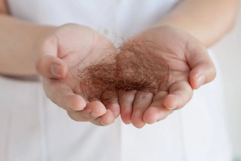 Chute de cheveux : comment réagir efficacement pour retrouver une chevelure abondante