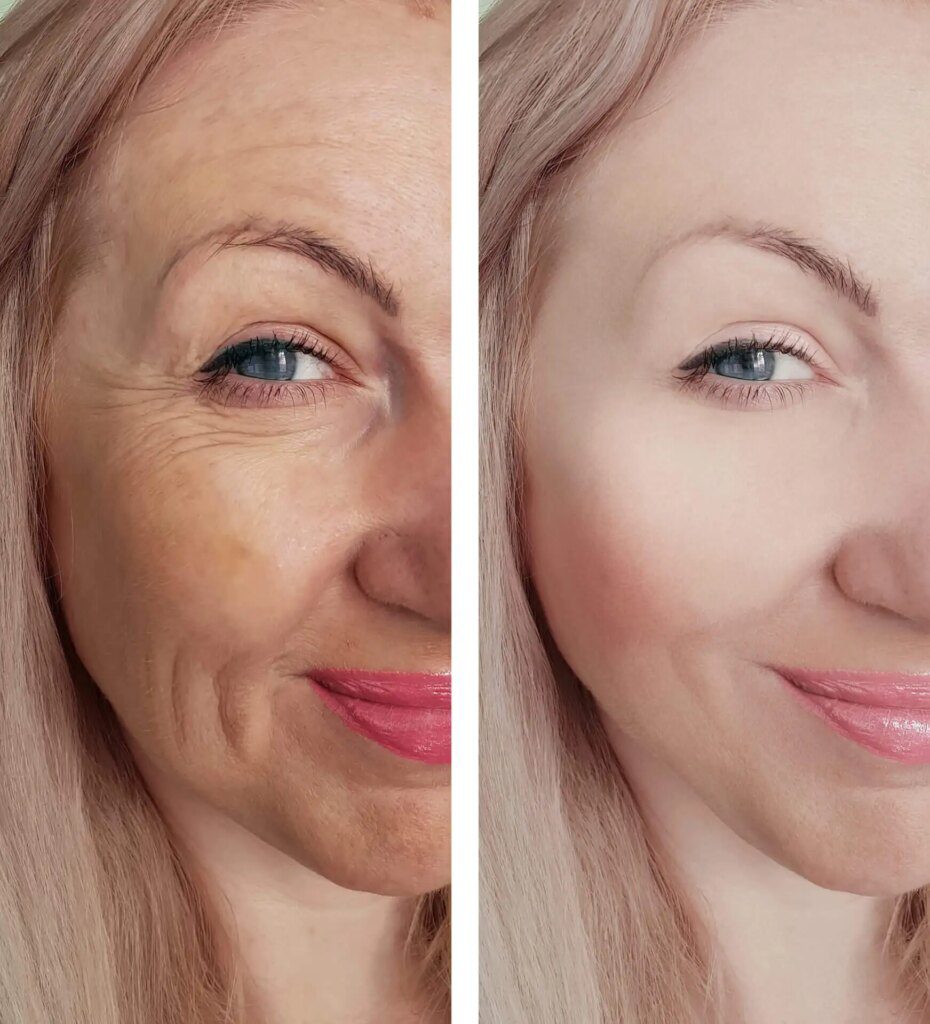 Les meilleurs soins anti-âge Les meilleurs soins anti-âge