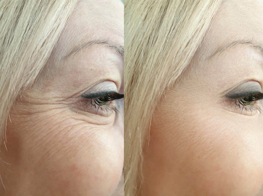 Raffermissement de la peau : techniques pour un visage rajeuni Raffermissement de la peau : techniques pour un visage rajeuni
