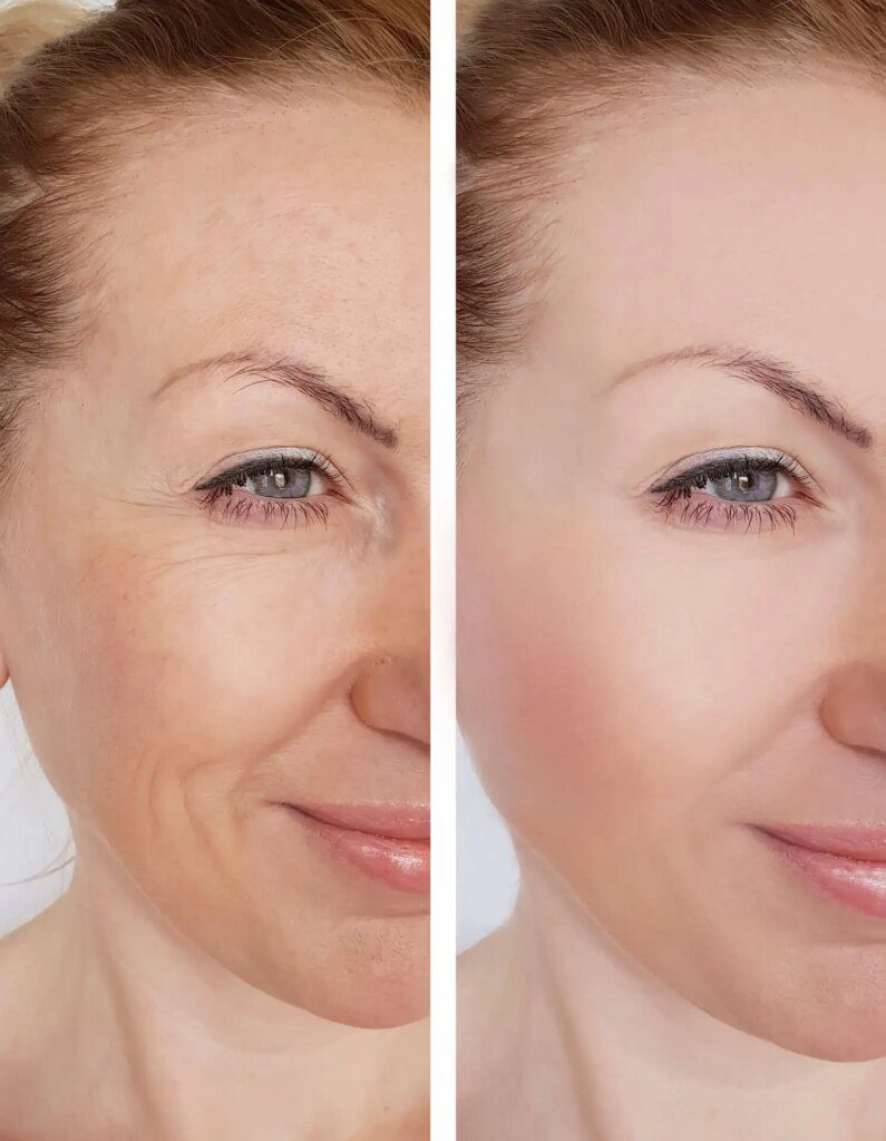 Rajeunissement du visage : les secrets d'un lifting énergétique Rajeunissement du visage : les secrets d'un lifting énergétique
